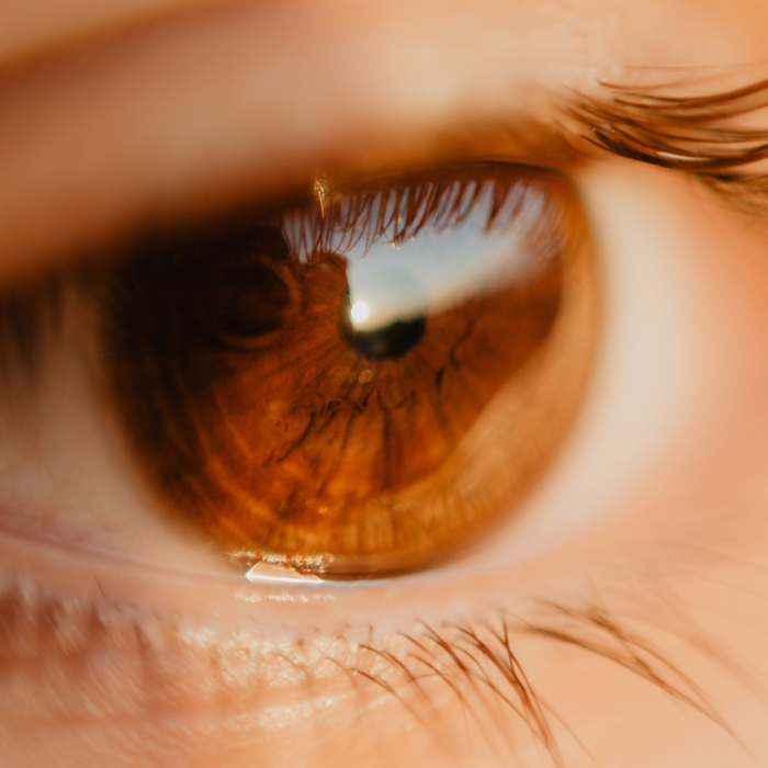 Laser Terapia Selettiva Glaucoma